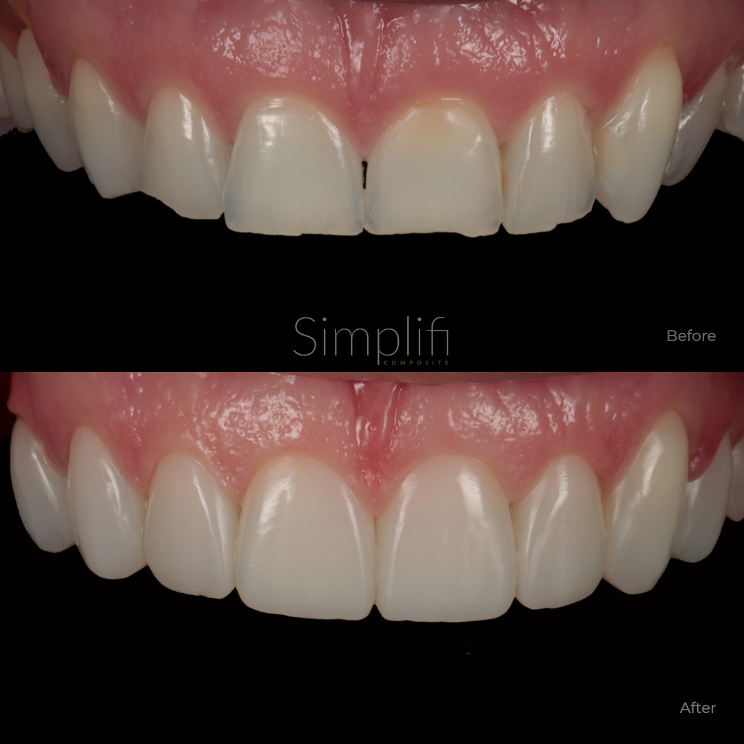 After Casework — professional dental case presentation